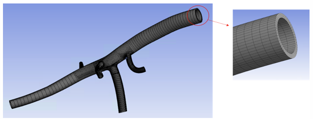 Mesh of the abdominal aorta model