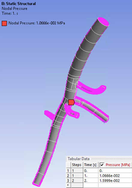 Loading on the Abdominal Aorta Model