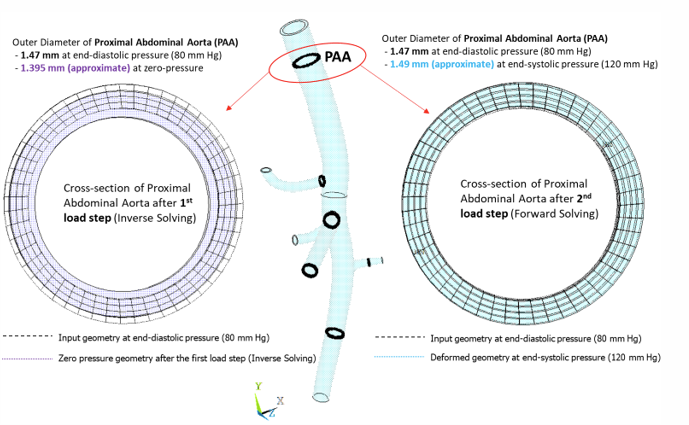 Deformation of cross-section at the proximal abdominal aorta location for various pressure conditions