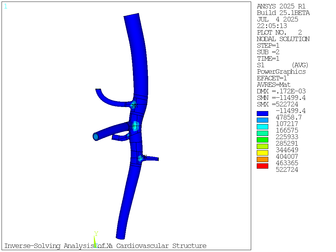 Maximum Principal Stress After Inverse Solving (First Load Step)
