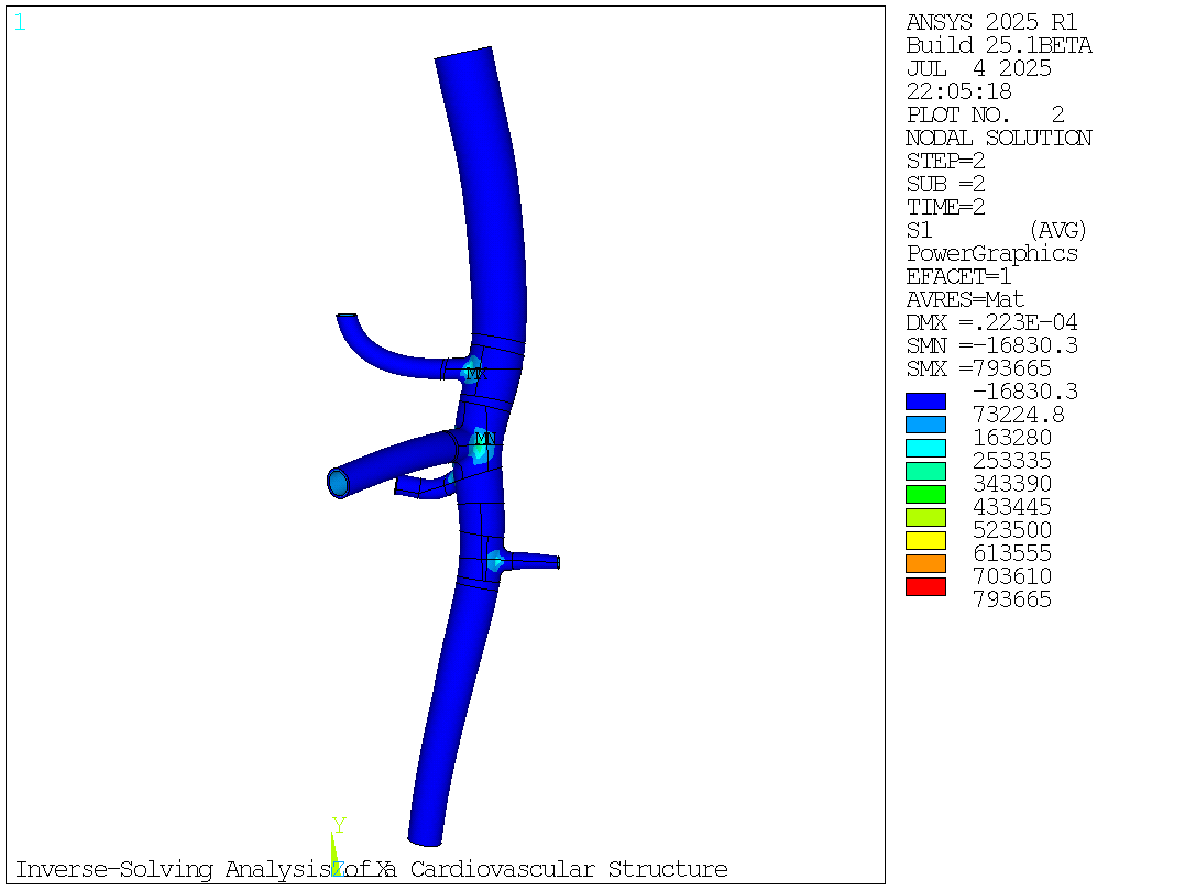 Maximum principal stress after forward solving (second load step)