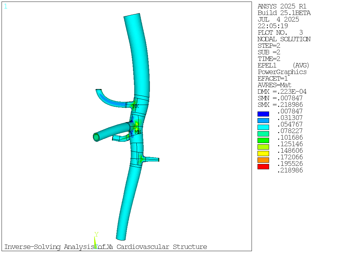 Maximum principal strain plot of the abdominal aorta model at end-systolic pressure (120 mm Hg)